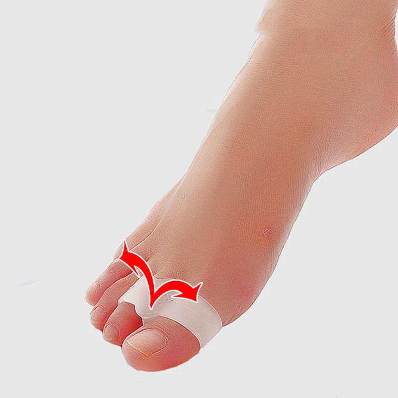 2 пары силиконовый разделитель для большого пальца сепаратор при захождении пальцев друг на друга ортопедические, подушки кривые, вальгусные ортопедические стельки для ног