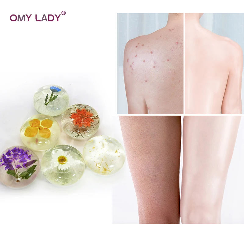 

OMY LADY Amino acid Handmade Soap 100% Pure Natural Plant Soap for Face Hand Body Bath Flower Soap Nourish Skin Anti-allergy