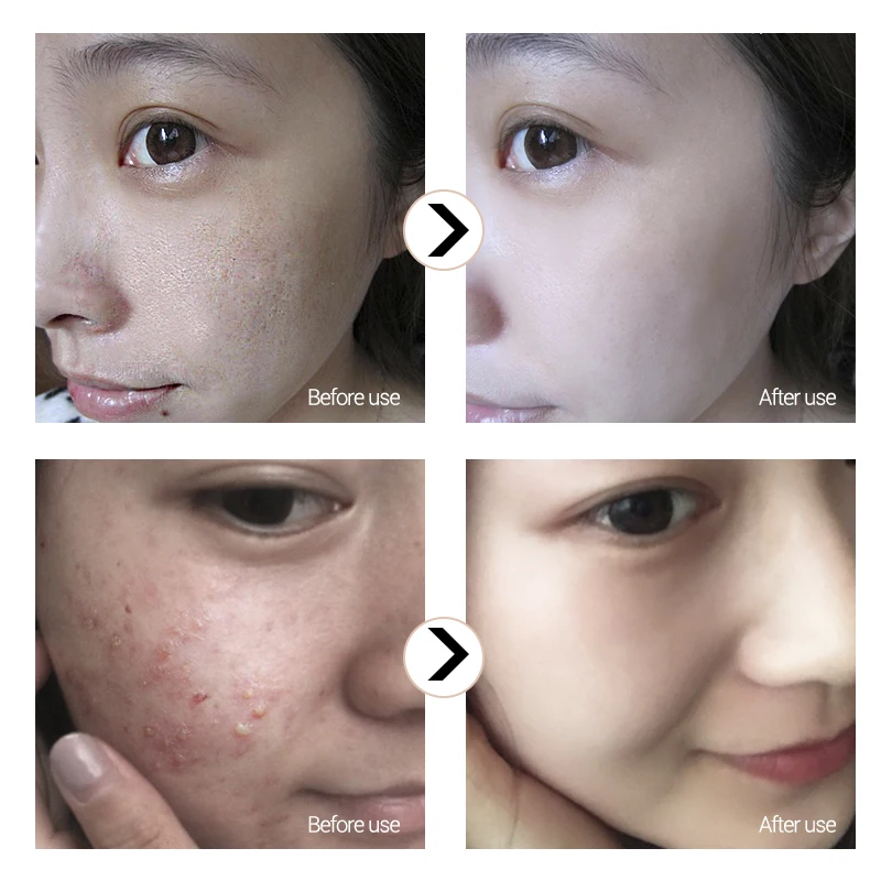Online BAIMISS Rot Granatapfel Essenz Erfrischende Feuchtigkeits Gesicht Serum Hautpflege Anti Aging Falten Serum Verbessern Haut Problem