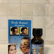 Лечение для ремонта тела | средство для удаления пятен масла | AFRIWORLD