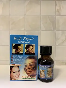 

Body Repair Treatment | Oil Spot Remover knuckle | AFRIWORLD