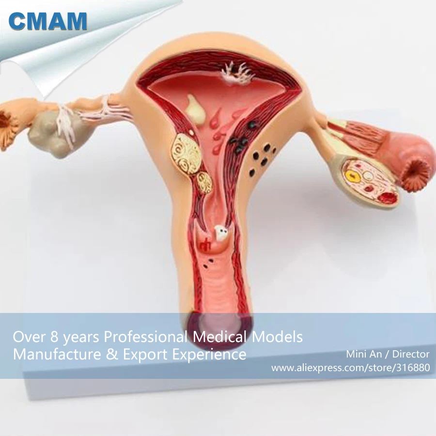 What is the size of the uterus 89 What is the size of the uterus 61
