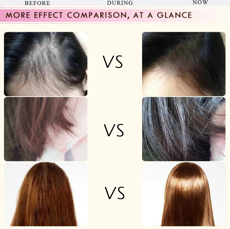 Жидкое лечение волос эфирное масло роста эссенция средства для роста волос предупреждающий потерю волос уход за волосами Andrea 35 мл 2 шт