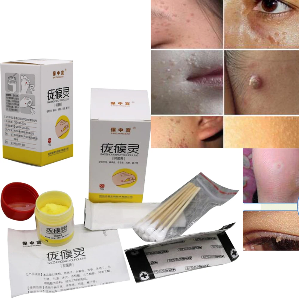 

Mole & Skin Tag Repair Solution Painless Mole Skin Dark Spot Repair Face Wart Tag Freckle Repair Cream Oil D224