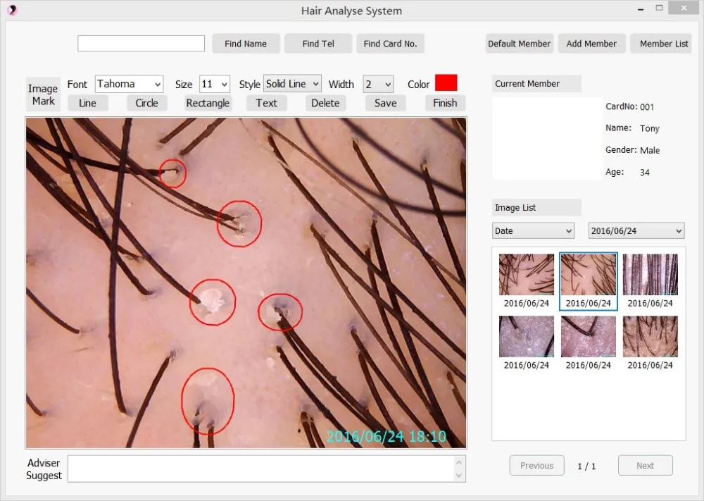analysis hair status