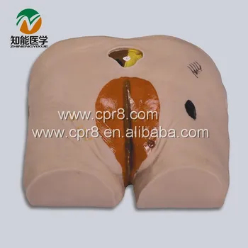 

BIX-H10 Senior Decubitus Pressure Ulcers Bedsore Nursing Model WBW220