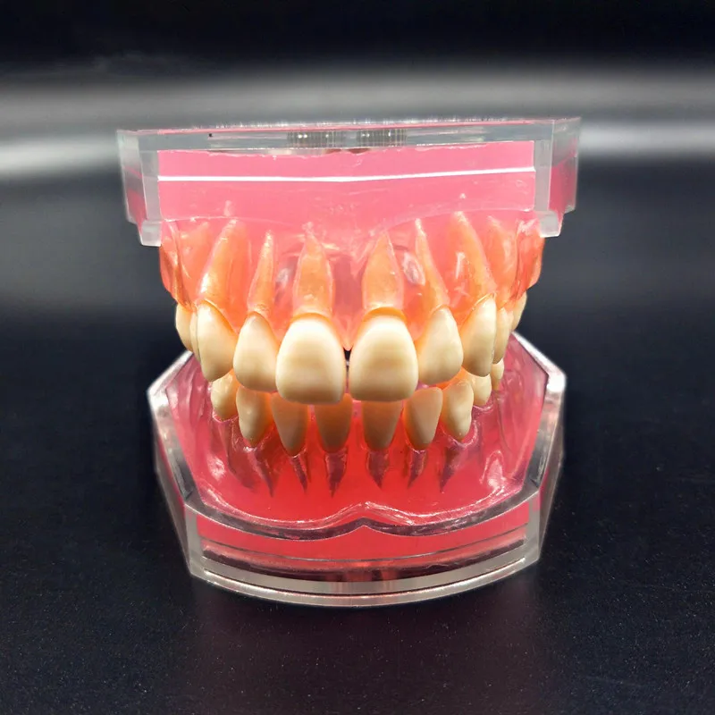 Dental Study Teaching Model Standard Model Removable Teeth Soft Gum ADULT TYPODONT Model Dental Study Teaching Model Standard Model Removable Teeth Soft Gum ADULT TYPODONT Model