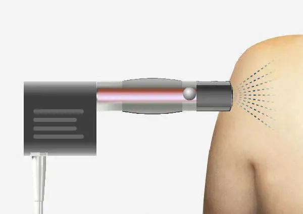 Новое поступление! Пневматические, противоударные волны терапевтическое оборудование устройство для физиотерапии колено боли в спине
