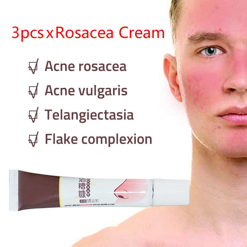 rosacea nose cream