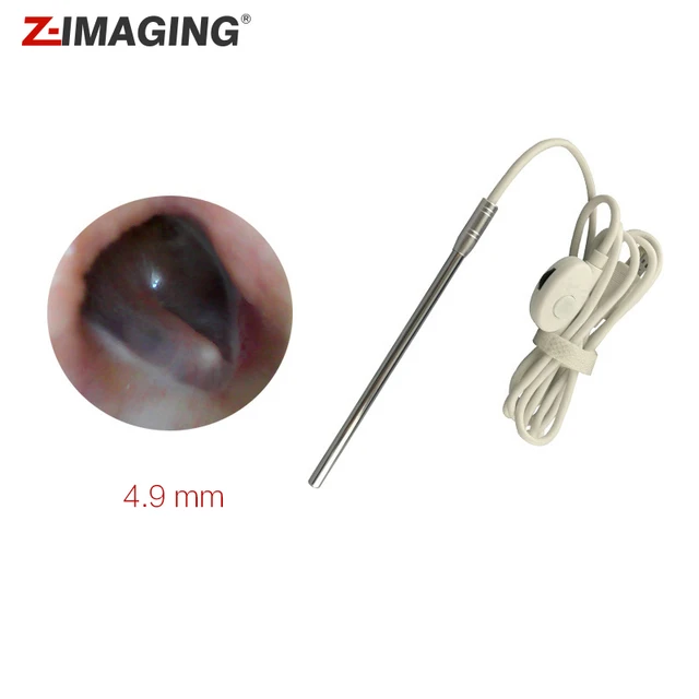 Otoscope Medical optic Otoscope USB Digital Nasal endoscopy Ear