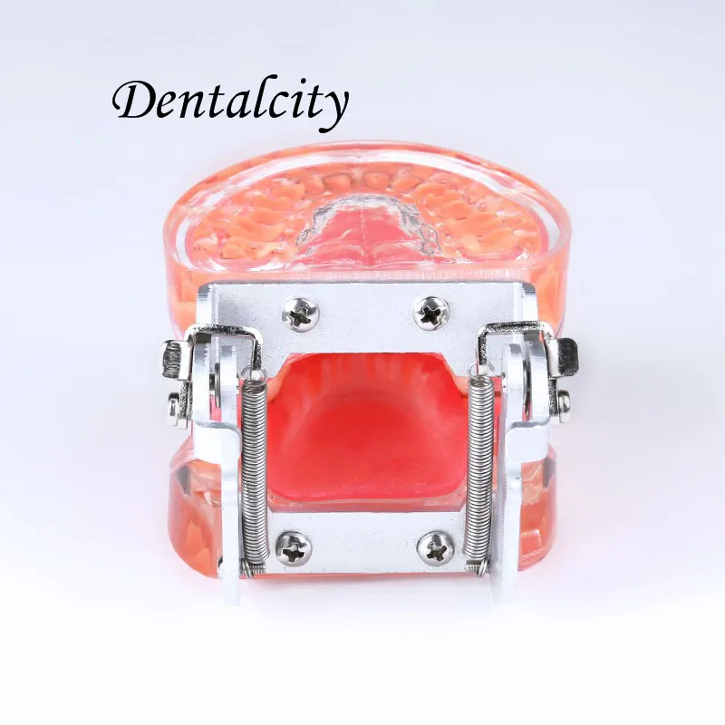 Modelo de Dentes Novo Dentais Typodon Adulto Doença Periodontal Patológica 4017 3 doença periodontal patológica 4017