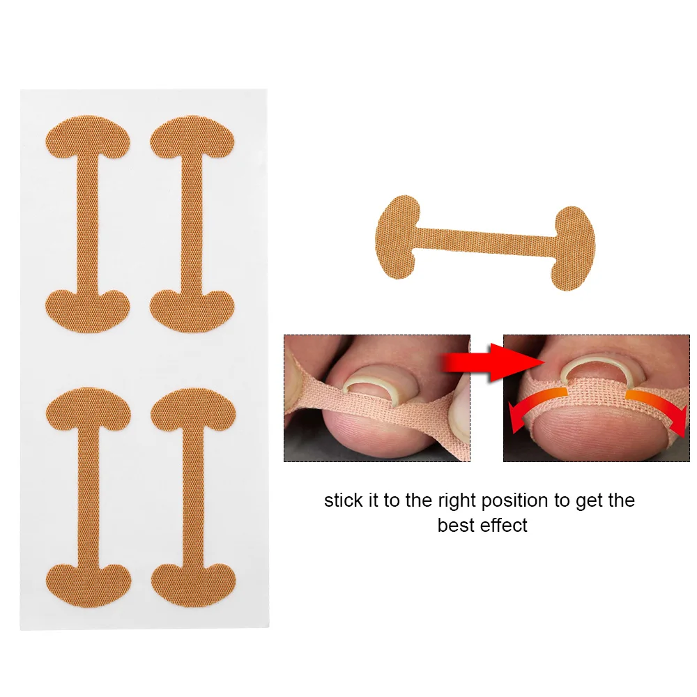 

12Pcs Ingrown Toenail Corrector Stickers Paronychia Treatment Recover Corrector Pedicure Tools Fingernail Toe Nail Care