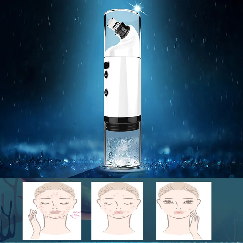 Новый вакуумный экстрактор 2 в 1 для увлажнения кожи и угрей с USB электрический