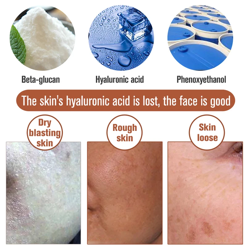 MEIKING Hyaluronic Acid Serum for Skin Anti-Aging Essence Hydration Moisture Non-greasy whitening face cream remove dark spots MEIKING Hyaluronic Acid Serum for Skin Anti-Aging Essence Hydration Moisture Non-greasy whitening face cream remove dark spots