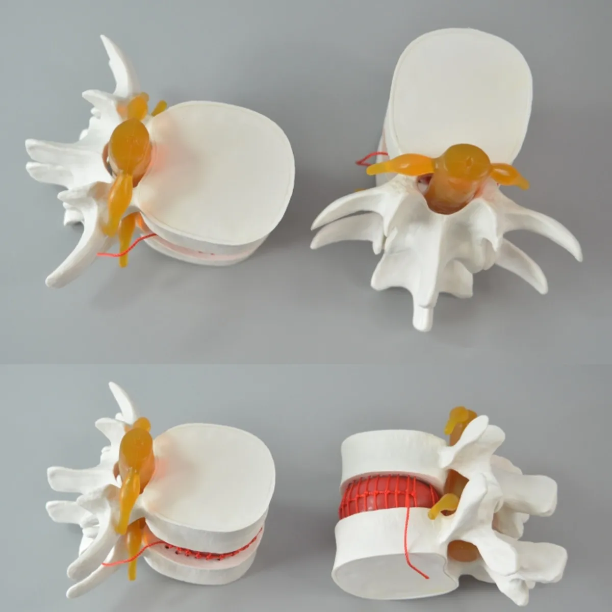 Человеческий анатомический Скелет спина поясница дисковая грыжа обучающая модель мозговой череп травматический пистолет школьные принадлежности медицинский инструмент