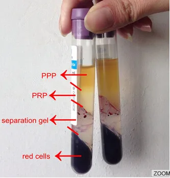 Популярная центрифуга PRP для 10 шт kit 8 мл 12 15 ACD гелевая трубка ухода за волосами и