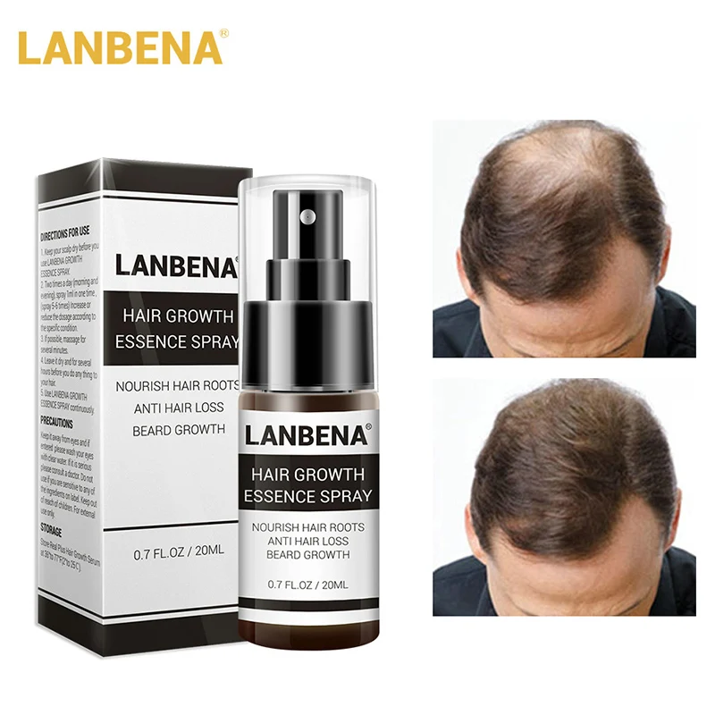 Hair Care Essence Spray 20ml Restoration Hair Loss Treatment Liquid