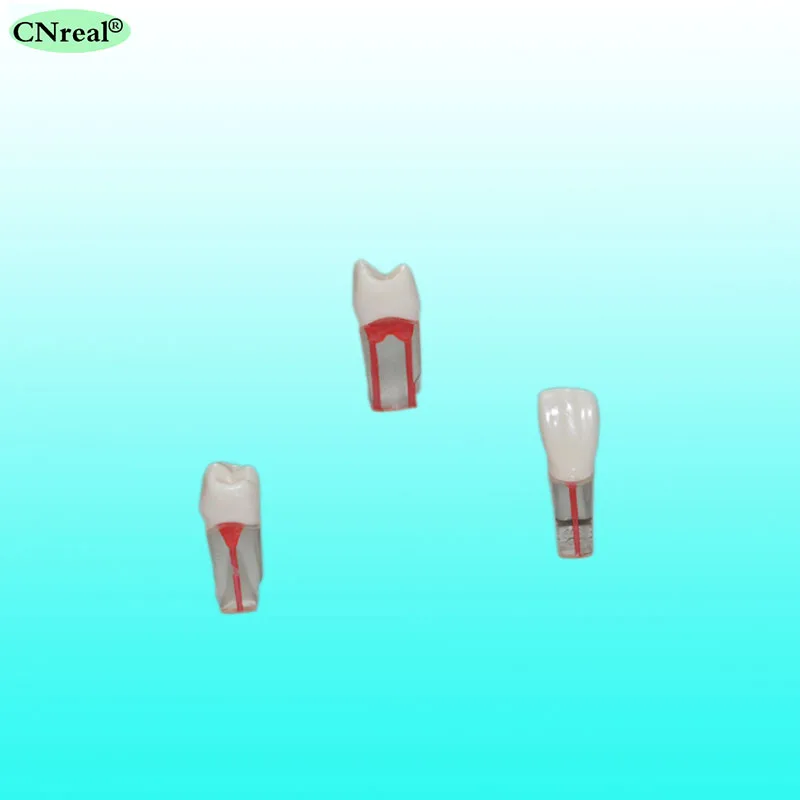Limited Offer 4 pcs/set Endodontic Practice Model for RCT Practice