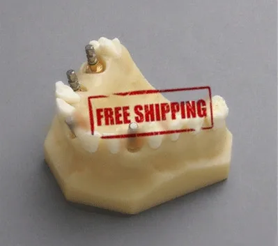 dental model 2012