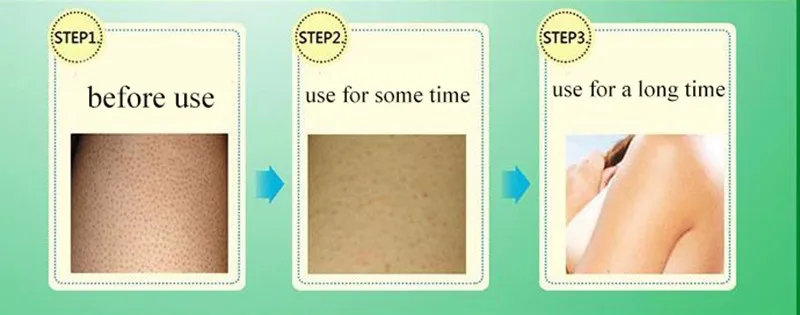 36020161020145731078