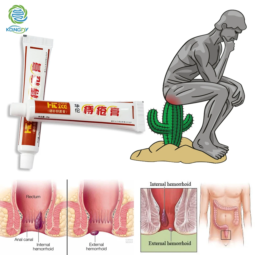 KONGDY 1 шт. крем от геморроя Китайский травяной внутренний геморрой сваи мазь и внешний анальный трещины ремонт боли