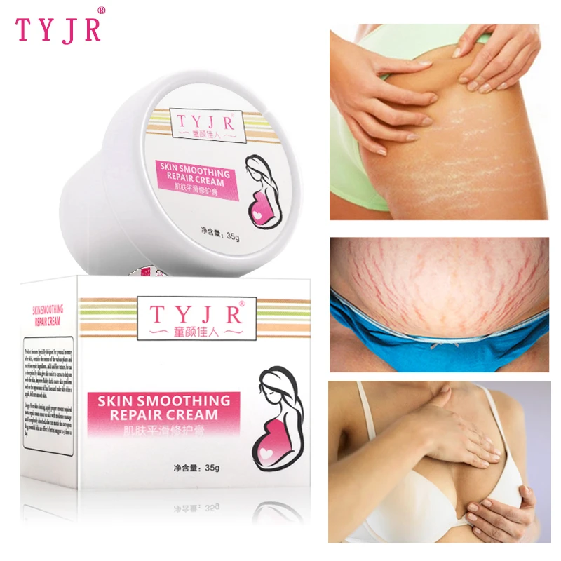 stretch marks on breast cream
