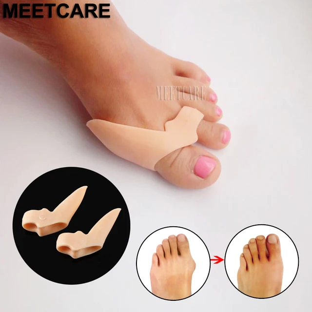 Buy 2pcs Foot Care Tool Silicone Gel Hallux Valgus Bicyclic Thumb Orthopedic