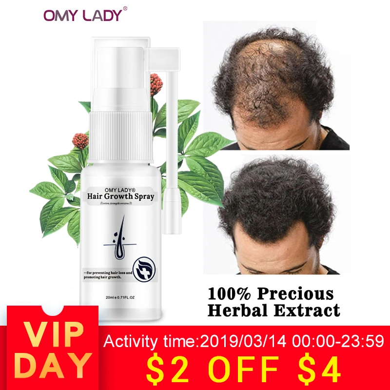 OMYLADY Anti Hair Loss Liquid Hair Growth Spray Essential Oil For Dry Hair Regeneration Repair Moisturizing Hair Care Products OMYLADY Anti Hair Loss Liquid Hair Growth Spray Essential Oil For Dry Hair Regeneration Repair Moisturizing Hair Care Products