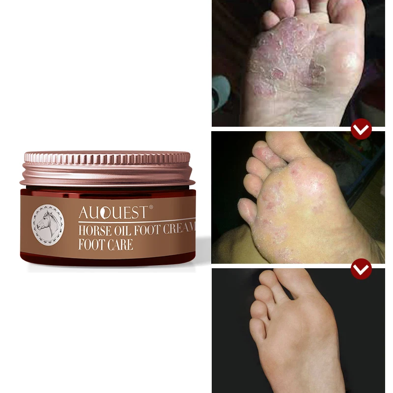 Foot Cream Moisturizing Horse Oil Itch Blisters Repair Anti Chapping
