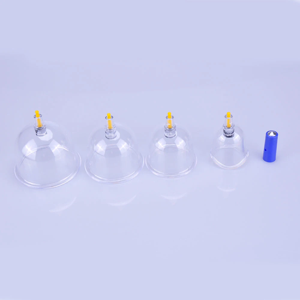 cupping7