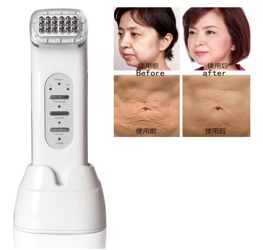 

RF Wrinkle Removal Beauty Machine Dot Matrix Facial Thermage Radio Frequency Face Lifting Skin Tightening RF Thermage Skin Sare