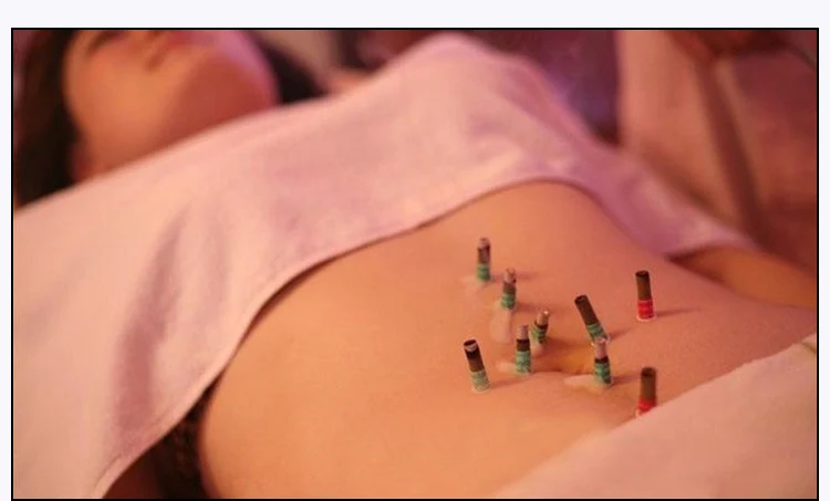

180pcs/pack for mini moxa paste moxibustion tube self-stick moxa roll warm moxibustion roll hanyi health
