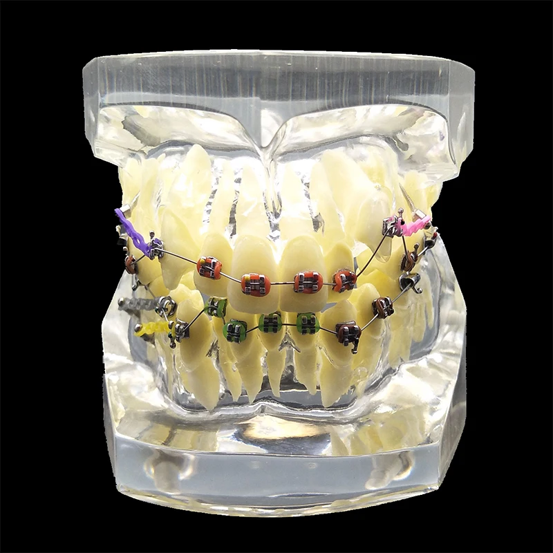 1PC Dental Orthodontic Study Model Transparent Teeth Malocclusion Orthodontic Model With Colorful Brackets&Hot Sale for Teaching цена 1PC Dental Orthodontic Study Model Transparent Teeth Malocclusion Orthodontic Model With Colorful Brackets&Hot Sale for Teaching цены онлайн