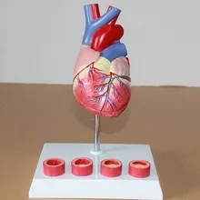 

1:1 Human heart anatomical model thrombus Medical teaching model free shipping