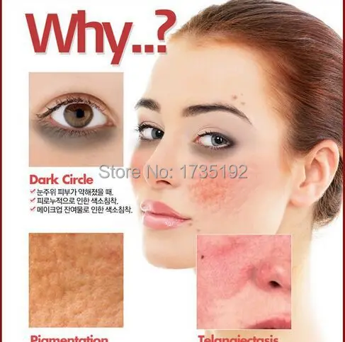 acne free in 3 days