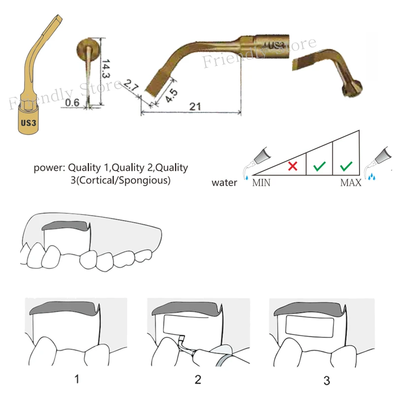 Стоматология 1 шт. US3 стоматологическая Piezo насадка для операций для синуслифтинг дентальные инструменты для MECTRON и высококачественная оконная оборудование