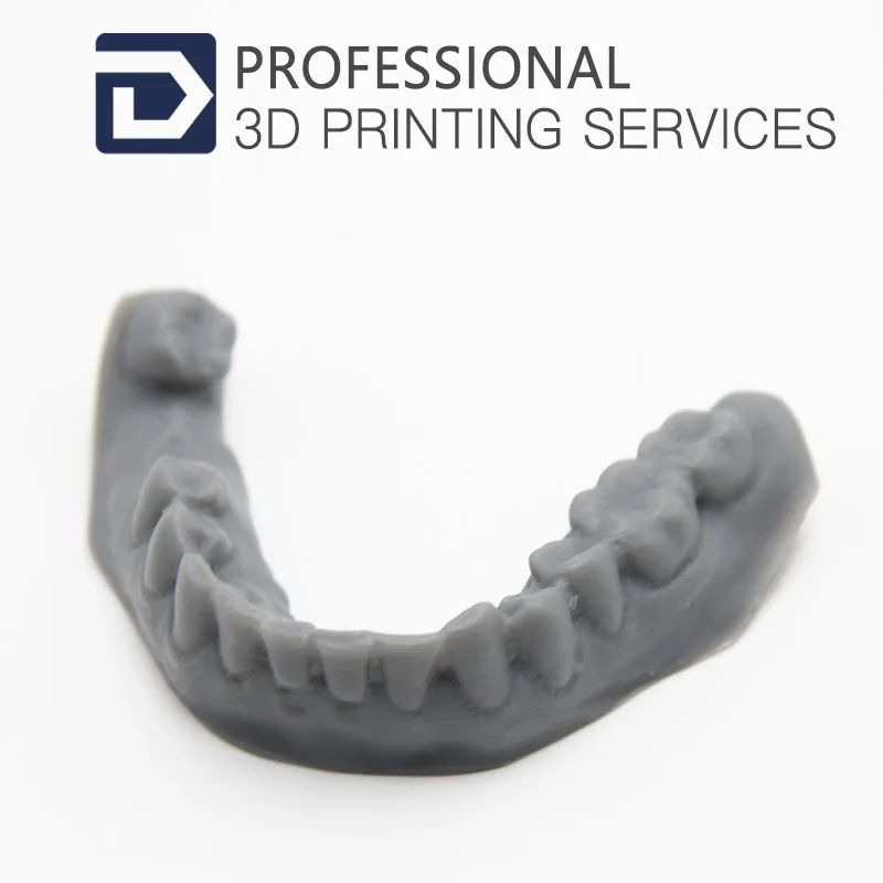 High precision resin dental model teeth 3d printing service