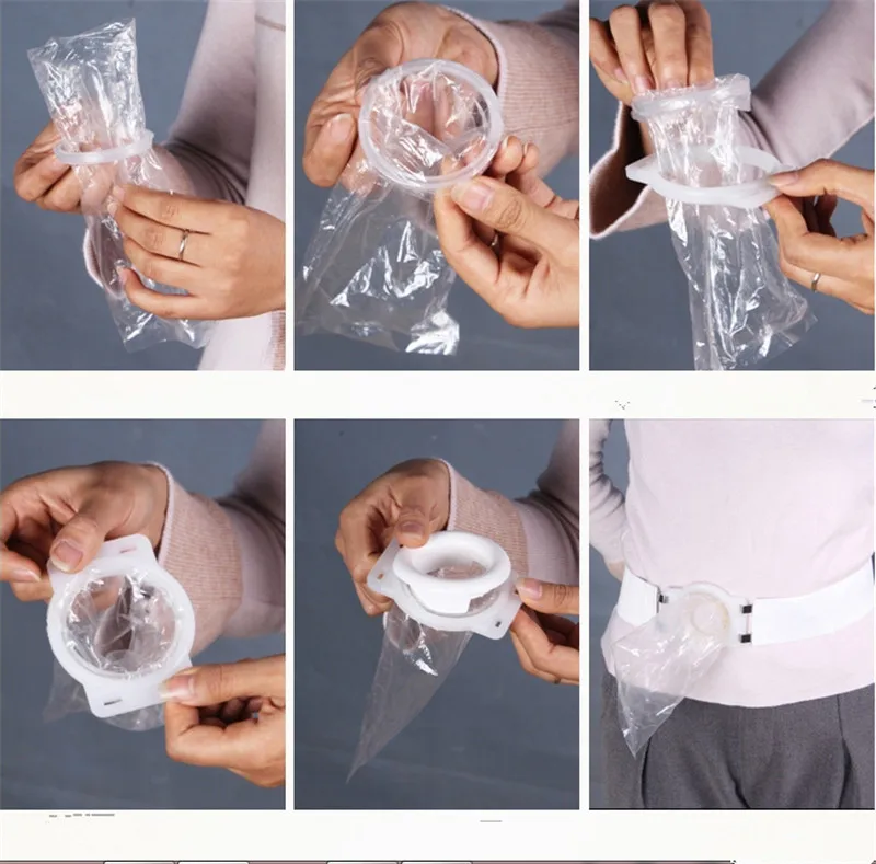 Мешки Ostomy Colostomy мешки для стомы|Брекеты и подставки| |