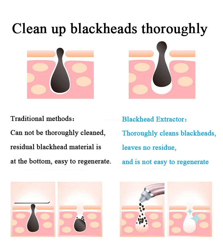 Blackhead-Vacuum-Extractor-Remover-Black-Head-Removal-Tool-Pore-Cleaner-Facial-Cleansing-Machine-Face-Skin-Care-Product-2018-New-arrivals (4)