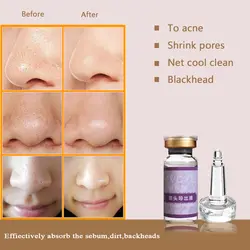 Уход за кожей Deep Softener угрей жидкий нос средство для устранения черных точек лечение акне глубокое очищение 10 мл
