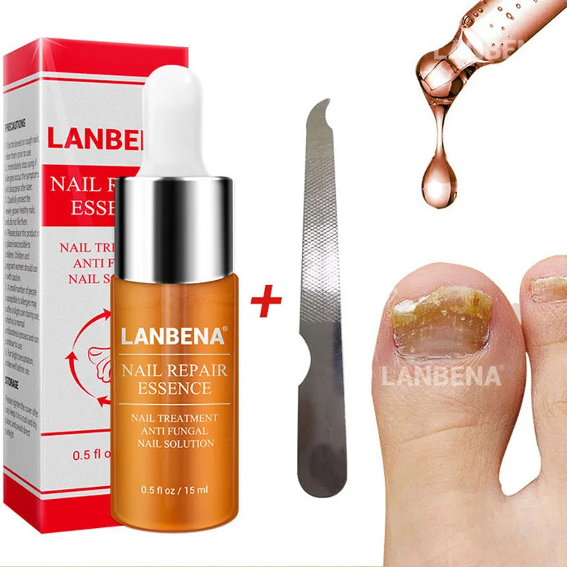 Lanbena élimination Des Champignons Des Ongles Essence