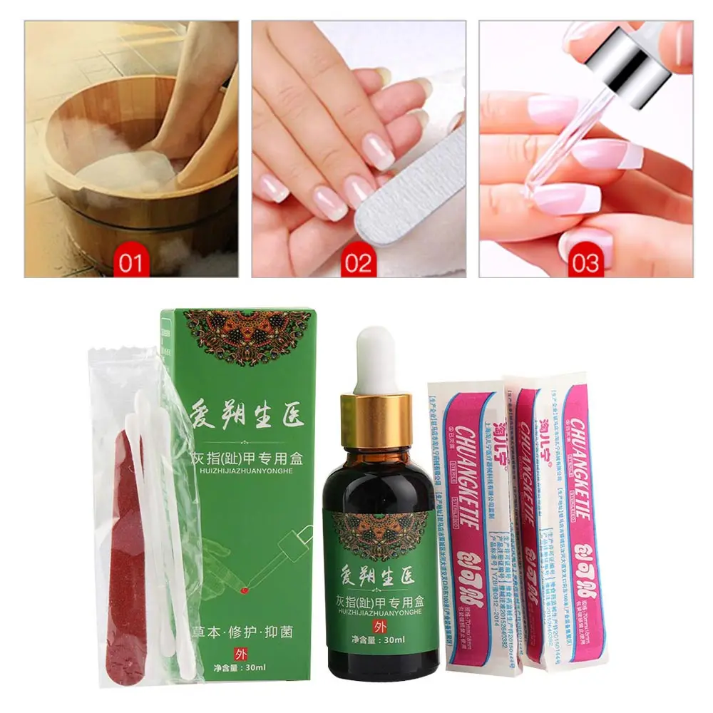 1 Bottle 30ml Herbal Onychomycosis Treatment Essential Oil Toe Nail