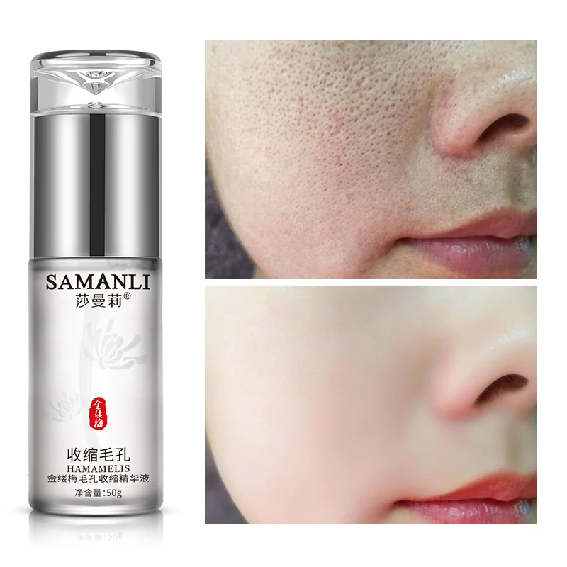 

Witch Hazel Shrink Pore Essence Skin Care Serum Moisturizing Hydrating Anti -aging Wrinkles Acne Treatment Face Care 50 ml