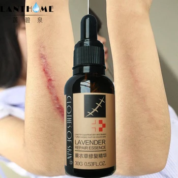 

Hot sell Essential Massage oils Scar Removal Lavender Oil For Pregnant Women Hyaluronic Acid Serum Oil Essential Face Anti Acne