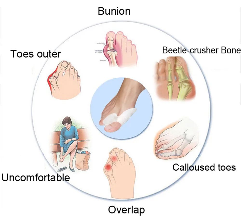 HTB1853mIXXXXXcXXpXXq6xXFXXX8