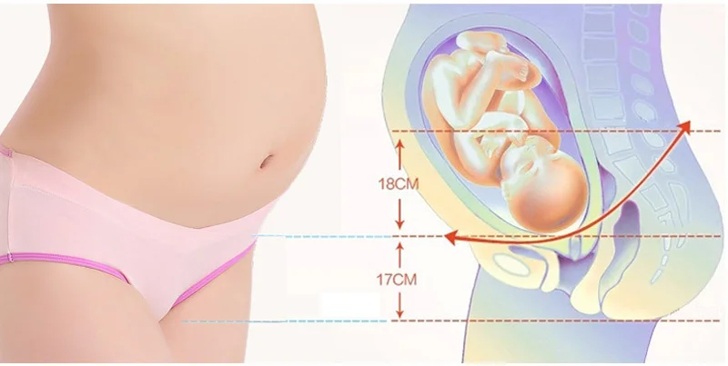 3801534880_729079002