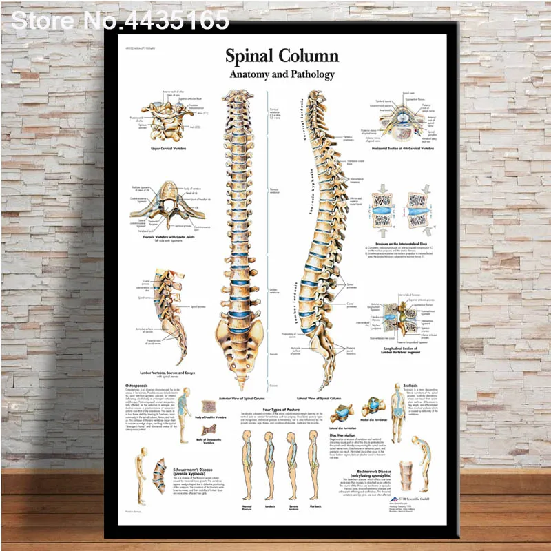 Spinal Column Chart