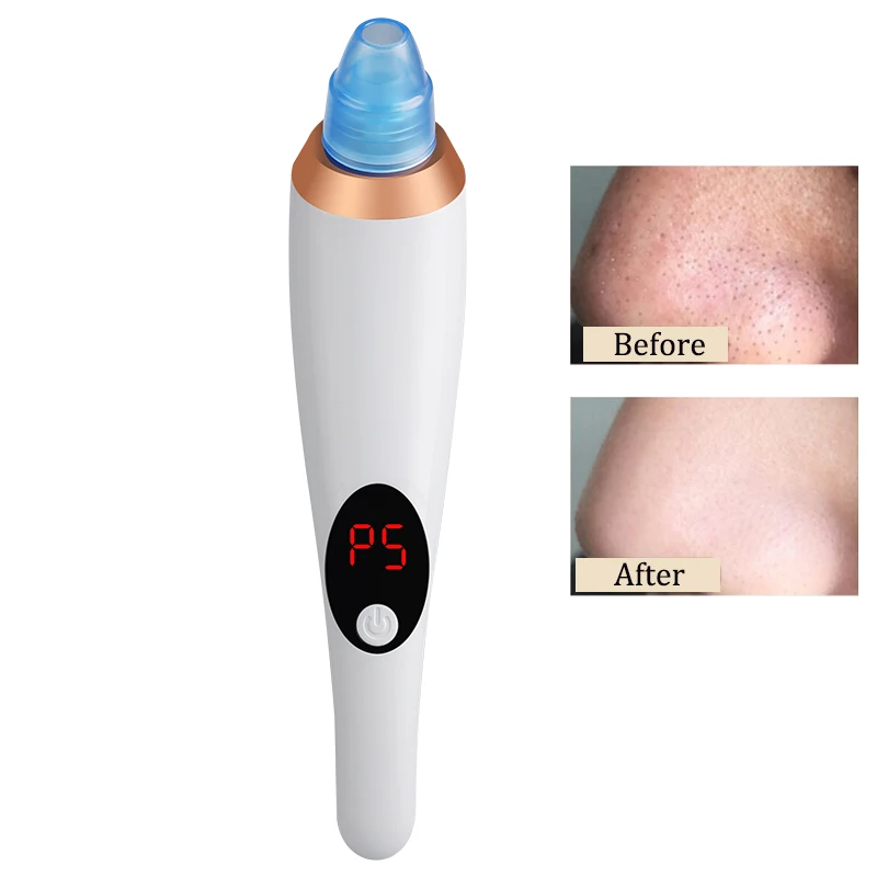 

Face Clean Vacuum Blackhead Remover Pore Acne Pimple Vacuum Cleaner Electric Blackhead Suction Tool Facial Diamond Dermabrasion