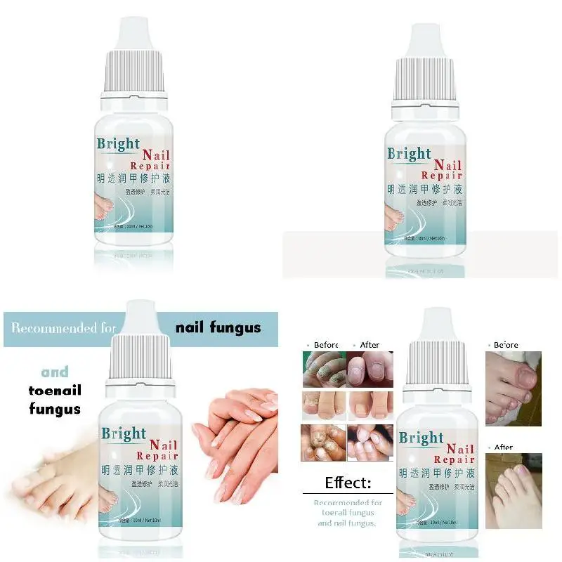 High Quality 10ml Nail Fungal Treatment Anti Fungus Onychomycosis Removal Toenail Care Nails Repair Liquid
