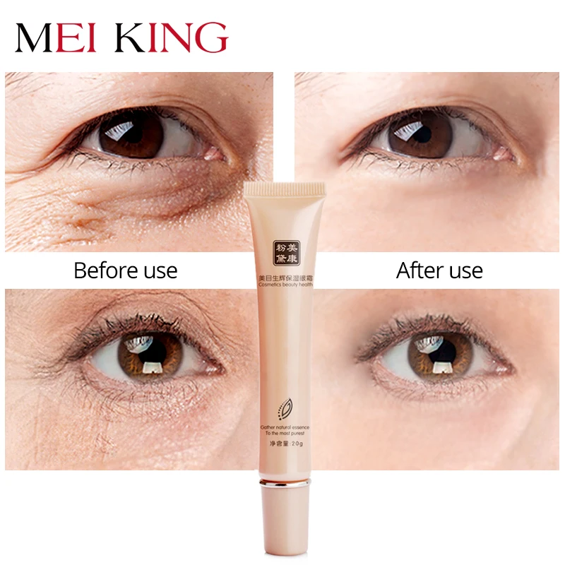 MEIKING Hyaluronic Acid Eye Cream Anti-Wrinkle Remover Dark Circles Eye Essence Against Puffiness Anti Aging Ageless Instantly hyaluronic acid snail glycerin jojoba oil instantly ageless lift wrinkle eye cream dark circles eye bags removal eye care cream